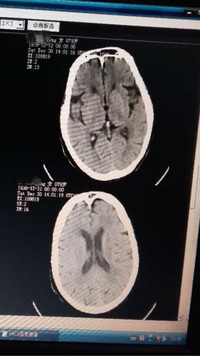 头部CT.jpg